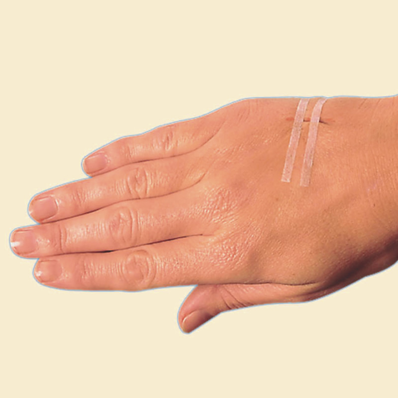 Смужка для закриття шкіри