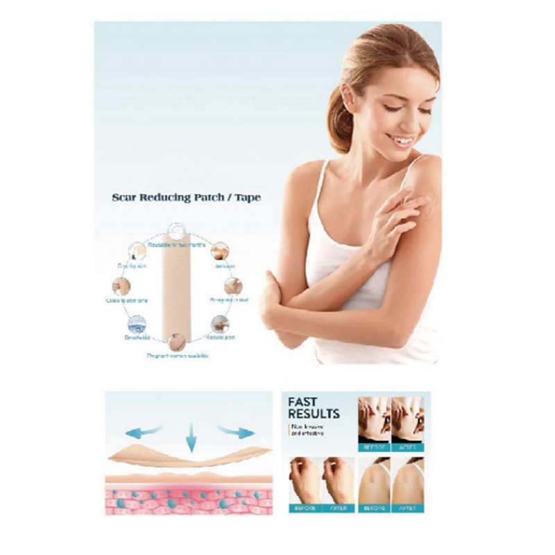 Силіконова пов'язка